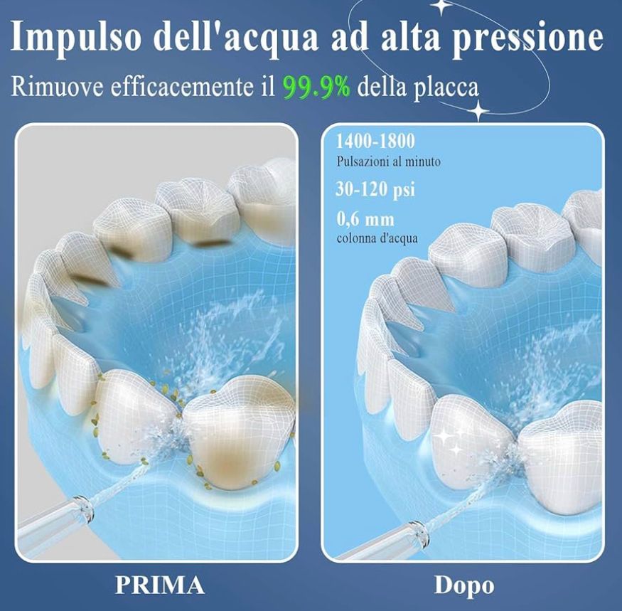 IDROPULSORE DENTALE - BRIXO